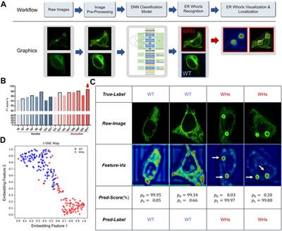 Deep Learning-Based Morphological Classification of Endoplasmic Reticulum Under Stress